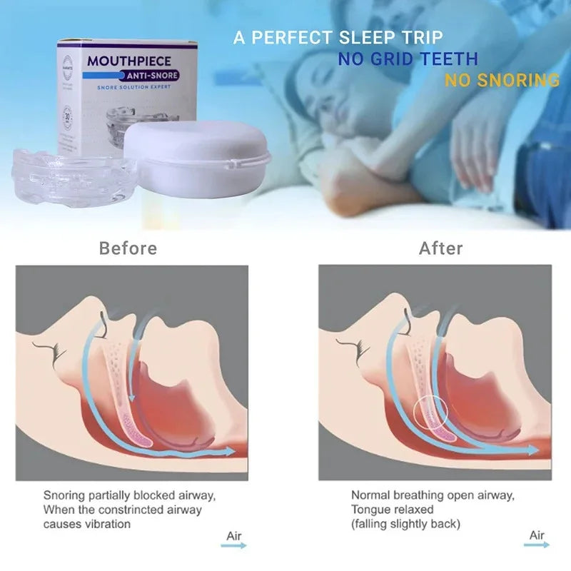 Korper™ Adjustable Anti-Snoring Mouthpiece - Stop snoring Instantly